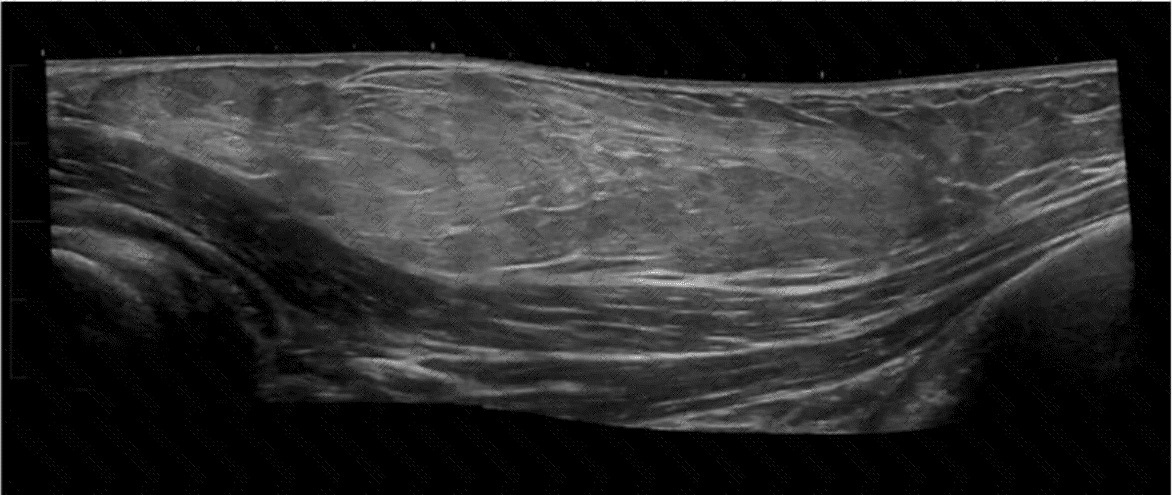 AB-Abdomen Question 48