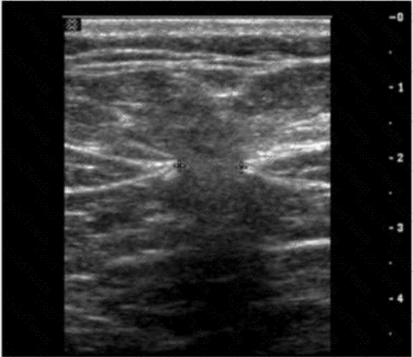 AB-Abdomen Question 34