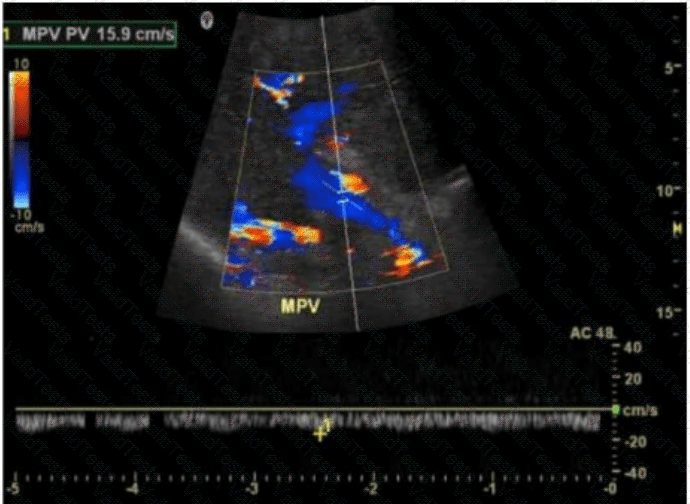 AB-Abdomen Question 44