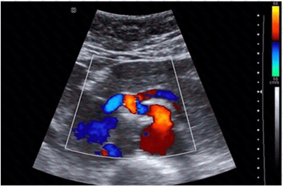 AB-Abdomen Question 20