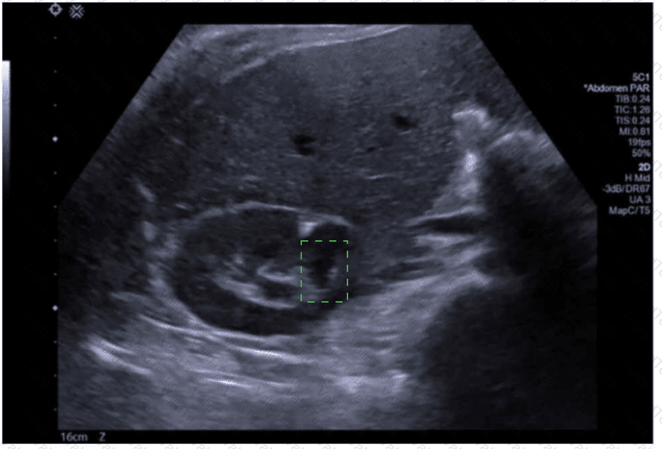 AB-Abdomen Answer 40