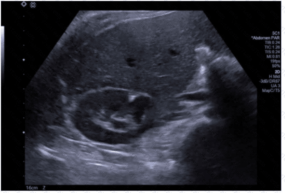 AB-Abdomen Question 40